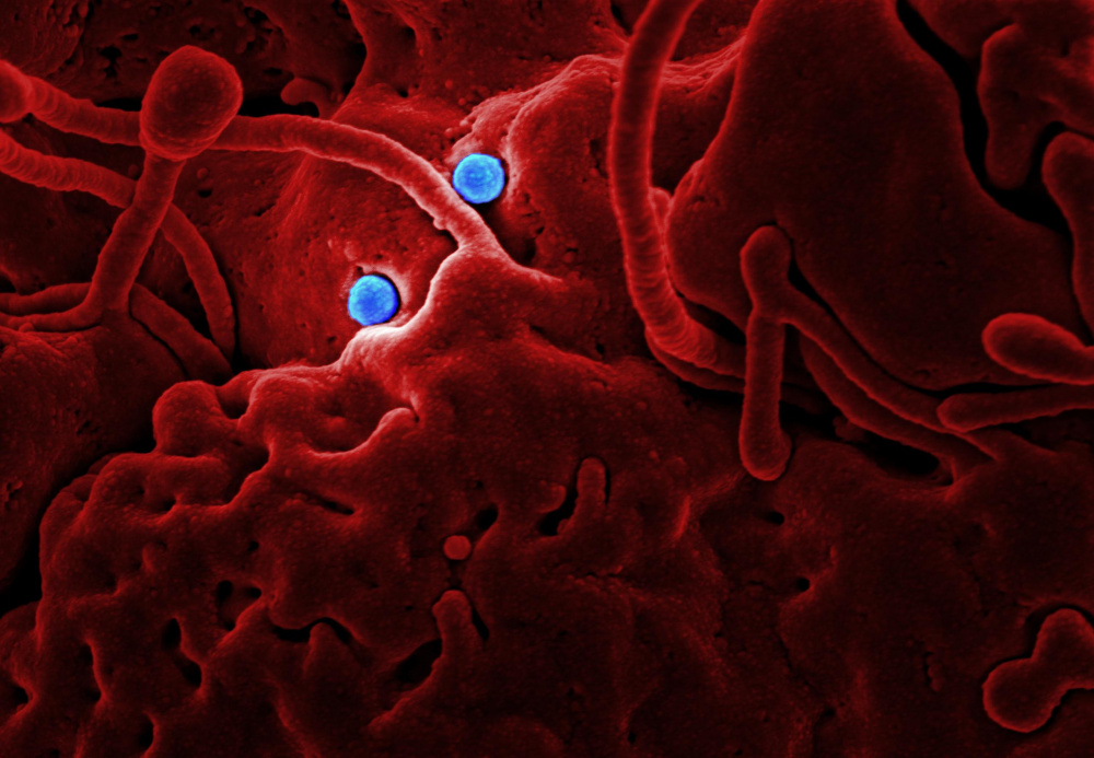 Один из ранее известных типов коронавируса. Фото: NIAID/Cover Images / TASS / Scanpix / Leta