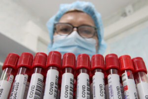 Образцы крови для анализа на Covid-19. Фото Sergei Karpukhin / TASS / Scanpix / Leta