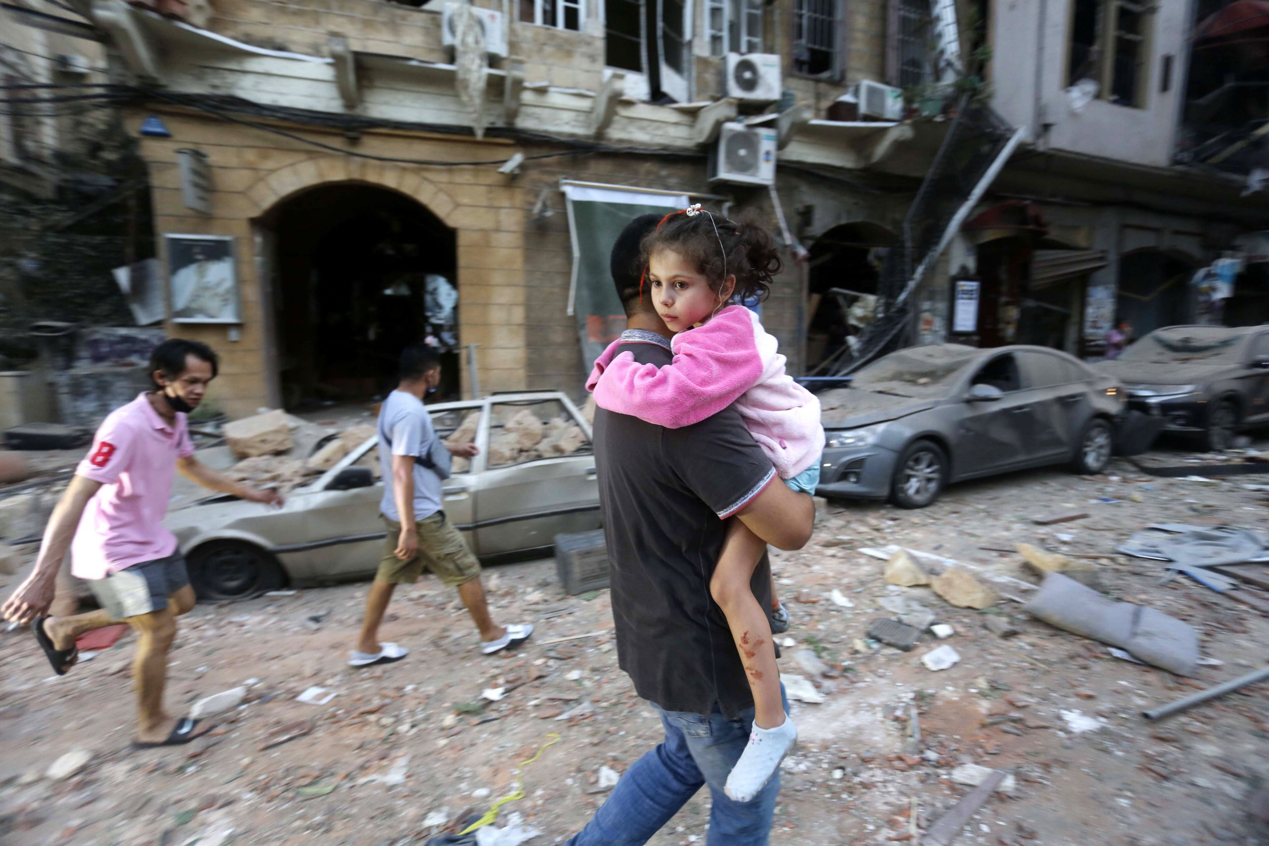Среди пострадавших также оказались дети. Фото Marwan Tahtah/APA Images via ZUMA Wire/Scanpix/Leta