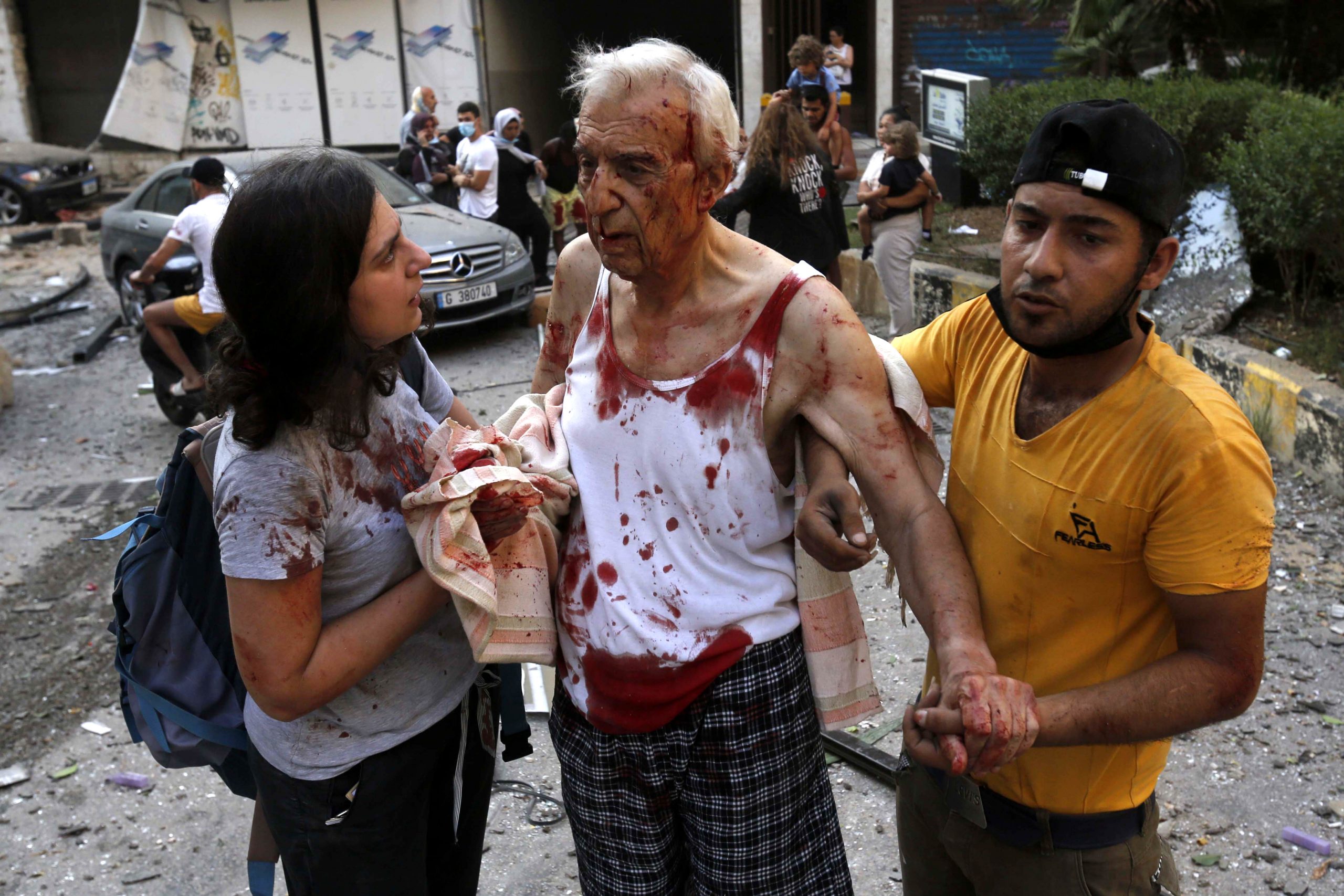 Один из пострадавших на улицах Бейрута. Фото Marwan Tahtah/APA Images via ZUMA Wire/Scanpix/Leta