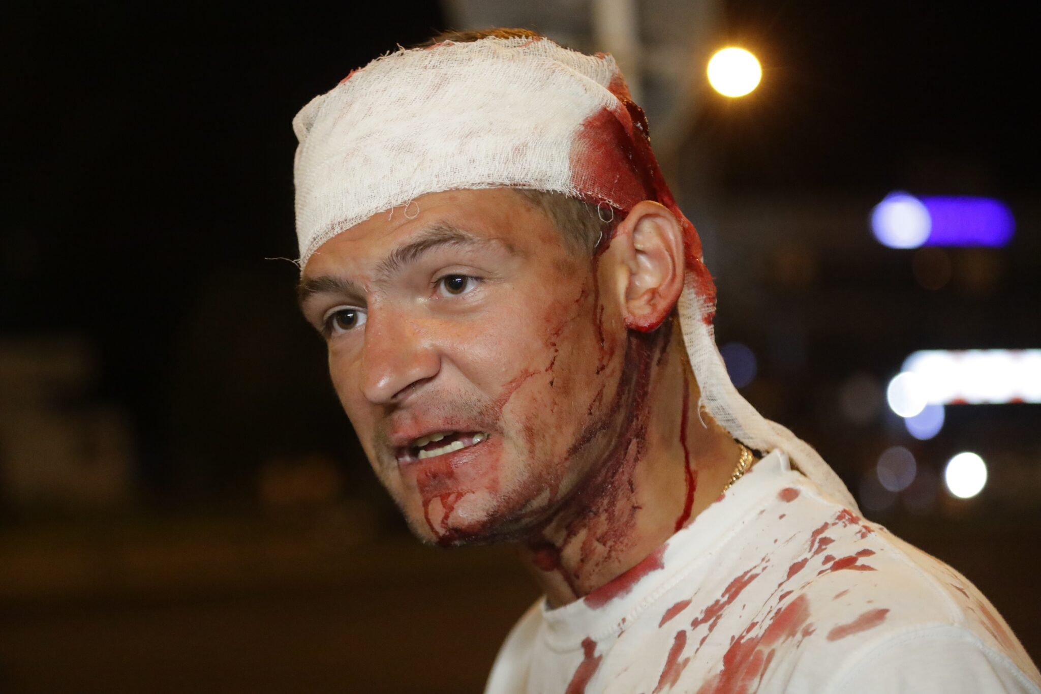 Раненый участник протестов в Минске. Фото AP Photo/Sergei Grits/Scanpix/Leta