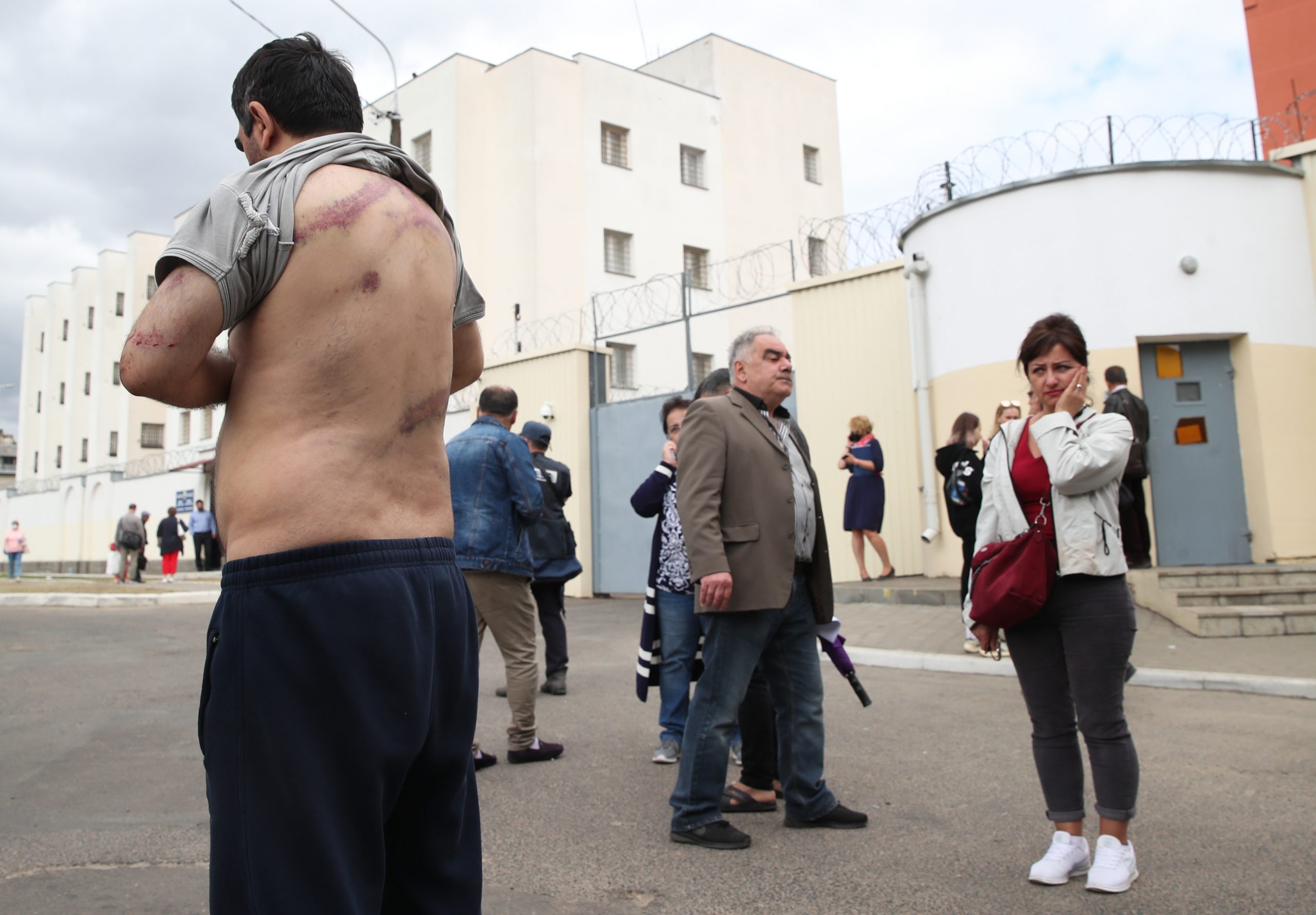 Отпущенный из изолятора мужчина показывает следы побоев. Фото Natalia Fedosenko/TASS/Scanpix/Leta