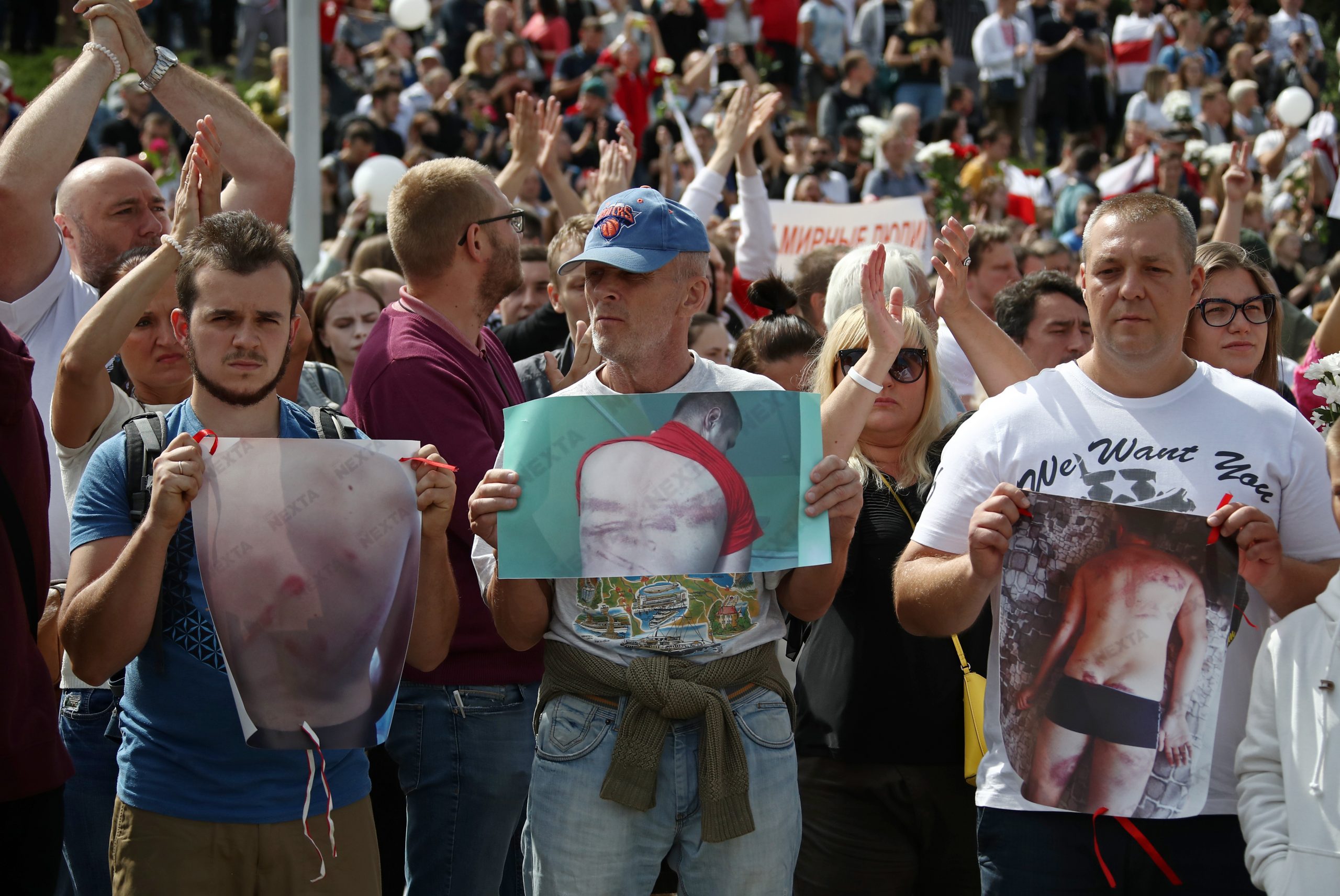 Участники акции памяти с плакатами, демонстрирующими следы от побоев силовиков. Фото Valery Sharifulin/TASS/Scanpix/Leta