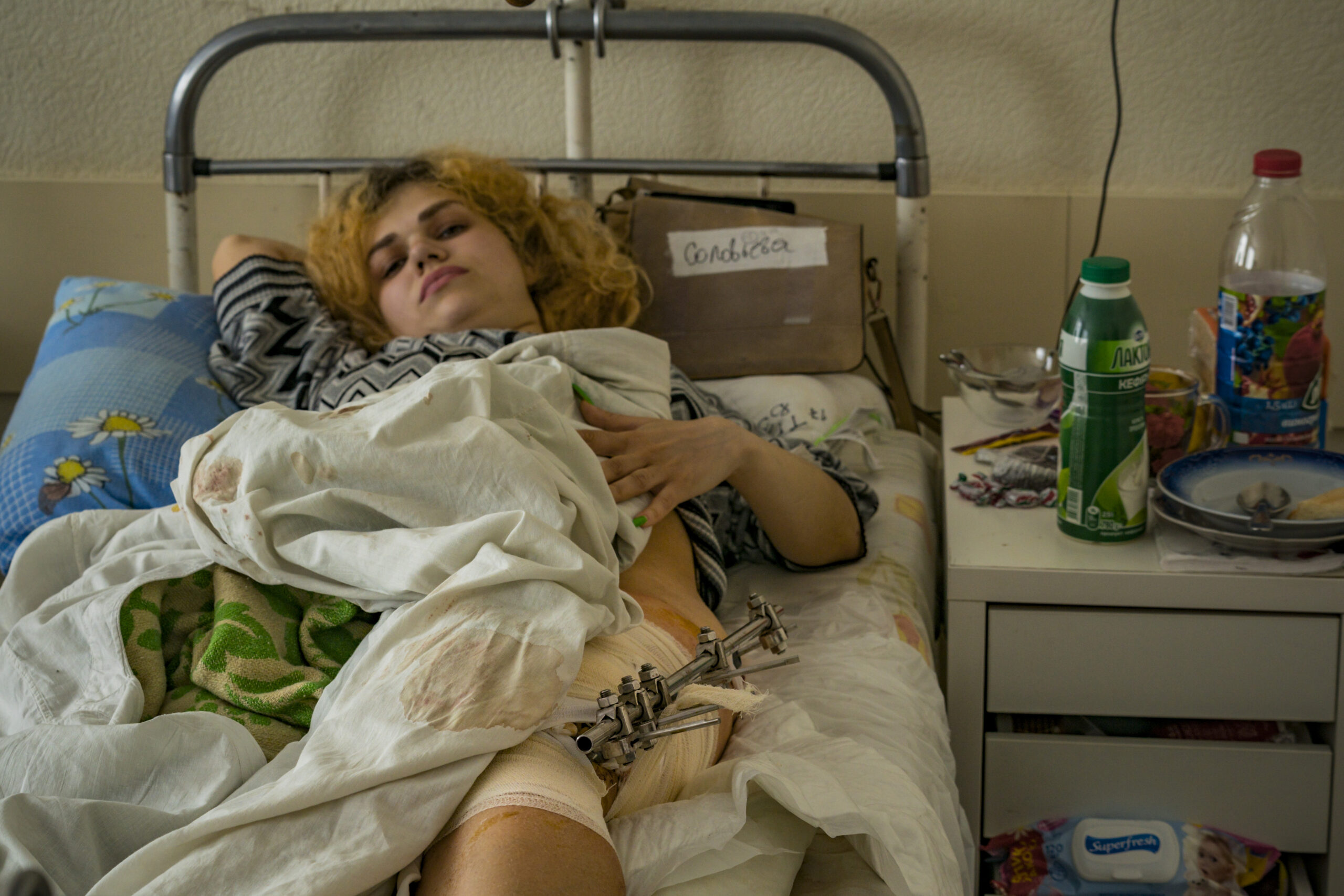 Женщина, раненая в результате обстрела в госпитале Харькова. Украина 3 апреля 2022 г. © Celestino Arce Lavin / Zuma / Scanpix / Leta
