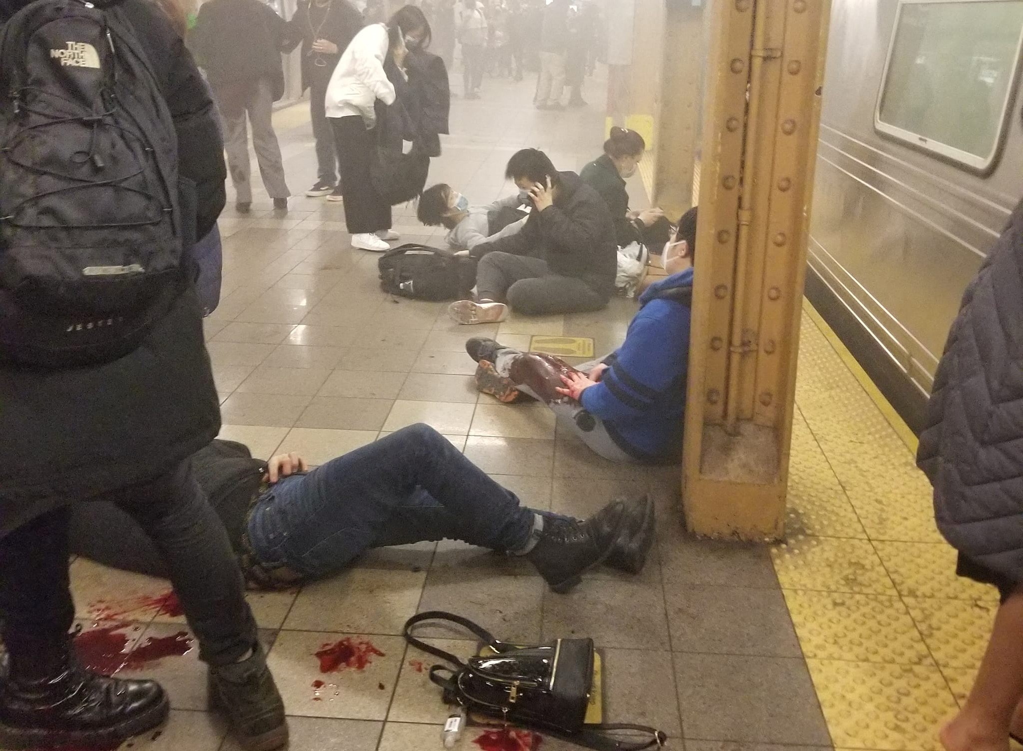 Раненые на станции метро 36th Street в Нью-Йорке. Фото Армен Арменян / Reuters / Scanpix / LETA