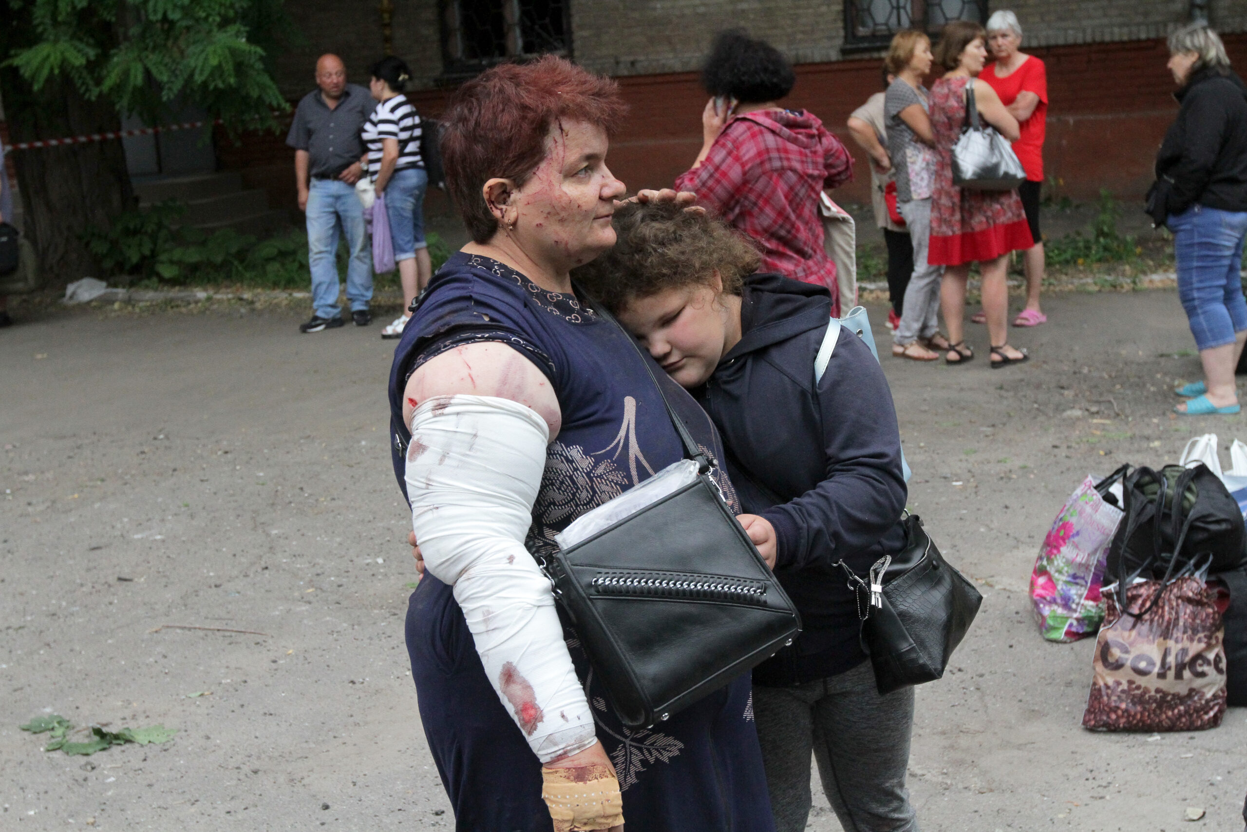 Мать и дочь, пострадавшие в результате ракетного удара по Днепру. 16 июля 2022 года. Фото Mykola Miakshykov/Ukrinform via ZUMA Press Wire/Scanpix/LETA