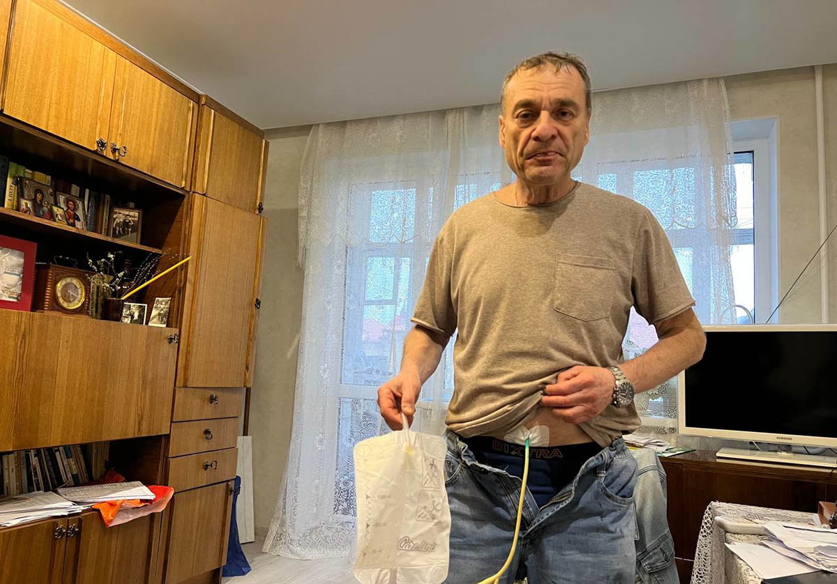 У Игоря Барышникова установлена специальная трубка в животе с мочеприемником. Фото SOTA