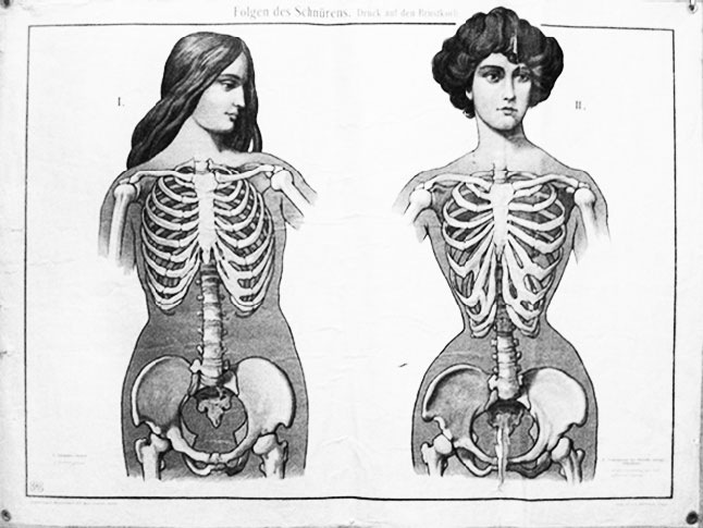 Устройство женщины образца 1884 г., немецкий плакат