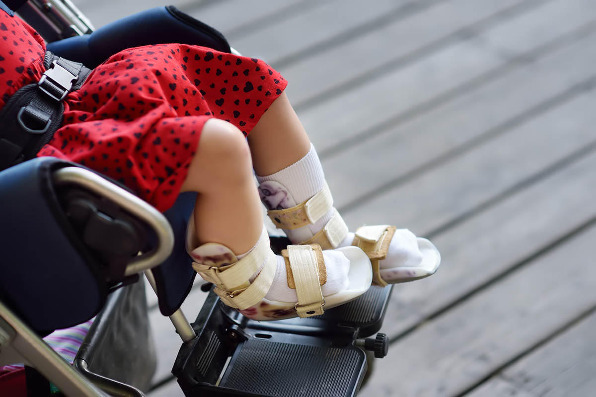 Девочка в инвалидной коляске. Фото SbytovaMN/istockphoto
