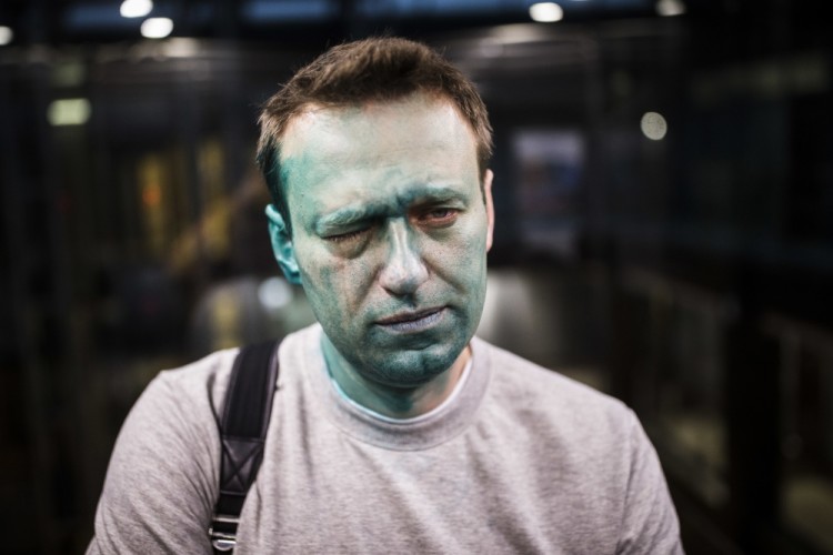 Алексей Навальный получил химический ожог глаза. Фото AP/Scanpix