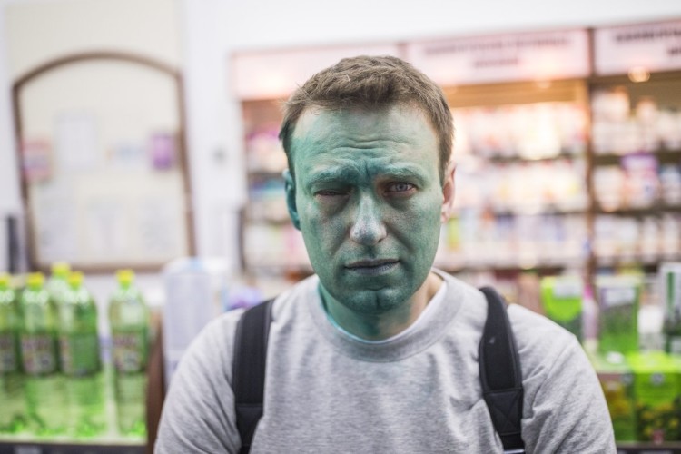 Алексей Навальный после нападения с зеленкой. Фото Евгения Фельдмана для проекта «Это Навальный»
