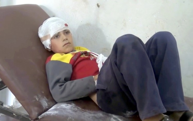 Сирийский мальчик, которому удалось выжить после обстрела школы. Фото: Syrian Revolution Network / AP / Scanpix